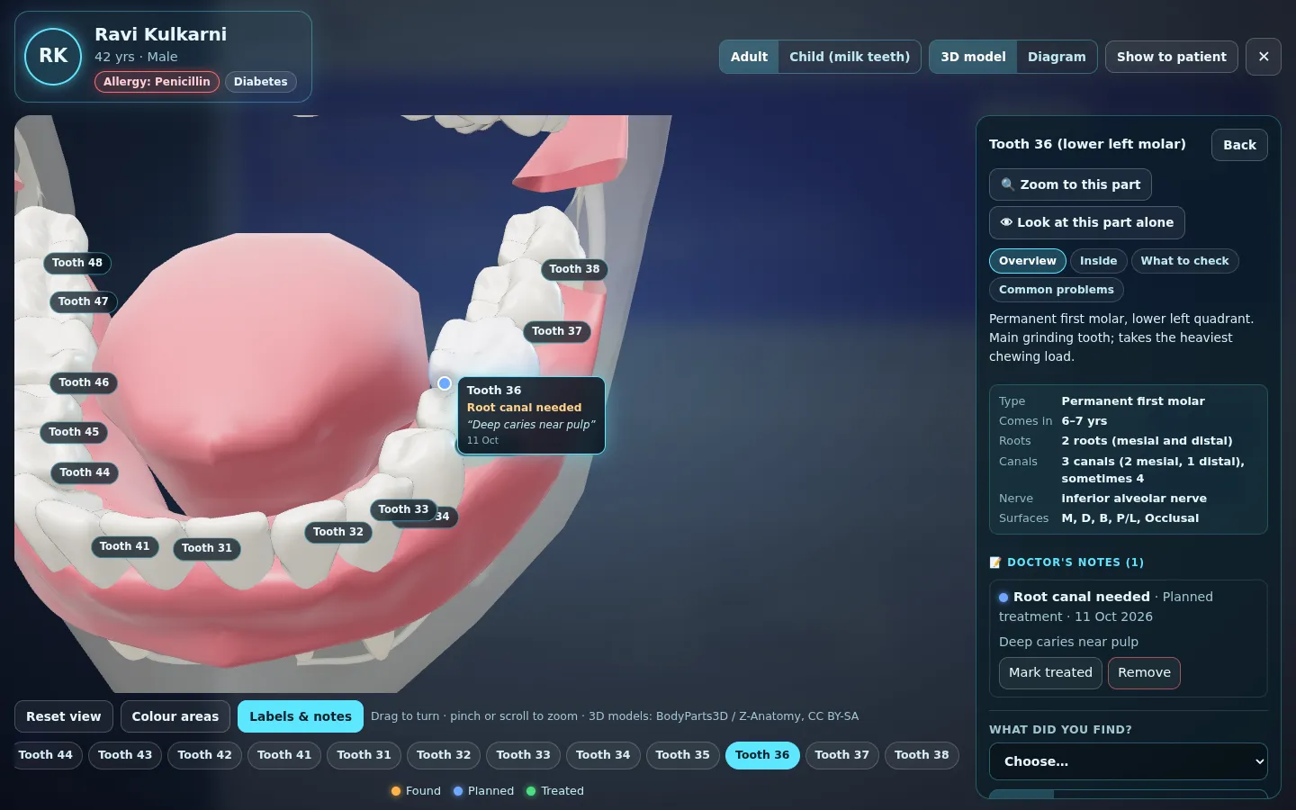 3D tooth chart with details and the doctor's note